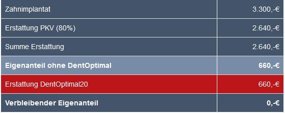 Beispielrechnung Zahnersatz für Privatversicherte